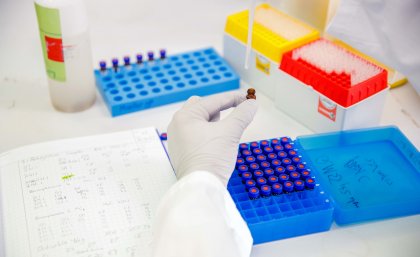 Sample preparation for PFAS analysis